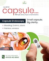 Image result for Wireless Capsule Endoscopy