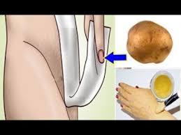 Pin On Health