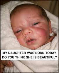 Girl with rare collins syndrome inspires worldwide