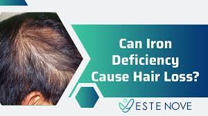Can iron deficiency cause hair there are just few studies proving that iron deficiency anemia can lead to hair loss in men or women. Can Iron Deficiency Cause Hair Loss Estenove Hair Transplant