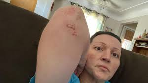 Jamie Runion Cancer Support