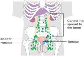 Pin On Health