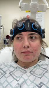 Job denial due to epilepsy medication