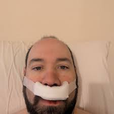 Fundraiser by Eric Kirkbride : Help Kirkbride Heal After Life-Saving Surgery