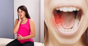 Meskipun obat kimia sangat ampuh untuk mengobati sakit gigi, namun beberapa orang terkadang tidak mau menggunakannya karena khawatir terhadap kandungan zat kimianya. Sakit Gigi Saat Hamil Penyebab Dan Cara Mengatasinya