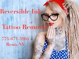reversible ink tattoo removal 2999 s