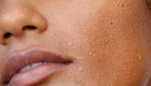 If the underlying condition causing the dryness is an underlying medical condition, even thought you might experience some symptoms (burning, itching, and irritation) with a person whose dry skin is caused by friction between legs, one would be. Dehydrated Skin How To Choose The Best Organic Skincare