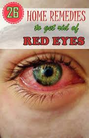 26 Effective Home Remedies To Get Rid Of Red Eyes Red Eyes Remedies Red Eyes Remedy