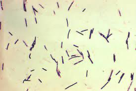 The disease usually occurs in two forms, including clinical and subclinical forms. Clostridium Perfringens Wikipedia