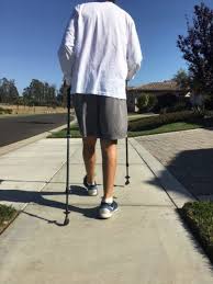 Walking 2 Weeks After Knee Replacement Surgery Knee Replacement Surgery Knee Replacement Knee Arthritis