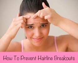 Then know how to get rid of acne to get that confidence back. Easy Fixes For Hairline Breakouts Womens Health Magazine How To Get Rid Of Acne Workout Motivation Women