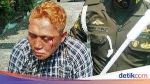 Catatan awal penggunaan manusia untuk lidah buaya berasal dari ebers. Cg4uxypvfzcldm