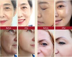 مرطب يومي يعني فيكن تستعملو ليل ونهار بس حابة وضح شغلة أن هالكريم مو سوبر  خارق لطبيعة 😊😊😊متل مو مفكرين البعض هو مكتوب ان معالج لتجاعيد وتصبغات  الشباب و بعالج الحبوب بس