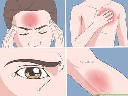 4 Ways To Get Rid Of A Headache Naturally - Wikihow