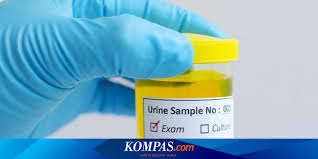 Santonin, amidopyrin, congored atau juga zat warna makanan. Urine Berwarna Oranye Merah Atau Biru Simak Artinya Di Sini Halaman All Kompas Com