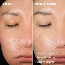 MIT Chemical Engineer and OAM CEO Jamira JC Johnson explains how our viral  eye cream erases dark circles 🤯