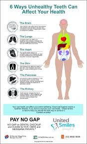 Peak bone mass is the greatest bone size and strength someone reaches in a lifetime. Mernda Dentist Trivia 6 Ways Unhealthy Teeth Can Affect Your Health