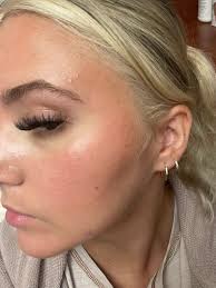 Sensitive skin with eczema