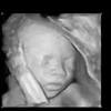 Is a noninvasive diagnostic exam that produces images that are used to assess organs and structures within the female pelvis. Https Encrypted Tbn0 Gstatic Com Images Q Tbn And9gctc3fvbgu5vbfhenbbhwjgg7skjmd59rutzy4kq67utrqtotgan Usqp Cau