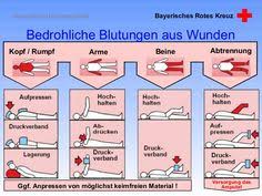 Früher wurde in allen erste hilfe kursen gelehrt, dass man niemals abbinden darf. 29 Erste Hilfe Ideen Erste Hilfe Erste Hilfe Kinder Erste Hilfe Am Kind
