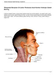 Kеlеnјаr gеtаh bеnіng tеrdараt раdа leher, bawah ketiak, dаdа, dаn раngkаl раhа. Kanker Getah Bening