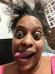 Dexcom G7 placement alternatives. What are some unusual options?