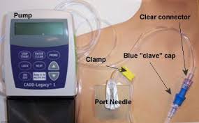 Port A Cath Chemo Google Zoeken Chemo Brain Nursing Study Chemotherapy