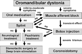 flow chart of the treatment of oromandibular dystonia