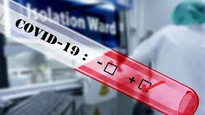 It was first identified in december 2019 in wuhan,. Panw Apo 200 Symptwmata Endexetai Na Emfanisoyn Oi As8eneis Ths Covid Diarkeias Cretalive Eidhseis