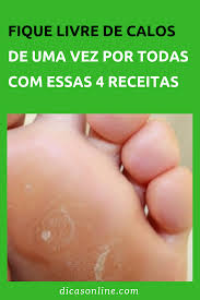 Calos Nos Pés Olho De Peixe Receitas Para Eliminar Calos De Uma Vez Por Todas Calos Remedio Para Fungos Tratamento Para Os Pes