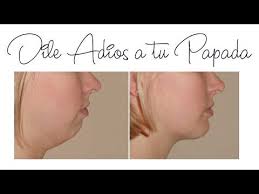 Eliminar La Papada Rapidamente Y Reafirmar Ovalo Facial Y Cuello Youtube Eliminar La Papada Como Eliminar Papada Reducir Papada