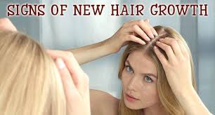 Do hair growth gummies and supplements actually help grow your hair? Hair Growth Supplements Can Work Know About The Working Flux Ur Yb