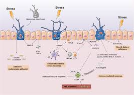 Image result for koebner phenomenon psoriasis