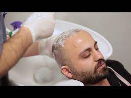 Istanbul Hair Center Sac Ekimi Sonrasi Yikama Nasil Yapilir Youtube Sac Ekim Youtube