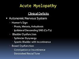They are both sudomotor dysfunctions. Neurological Emergencies Stephen Deputy Md Acute Ischemic Stroke
