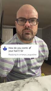 Combing the bald head everyone has a hobby — whose hobby is the craziest?