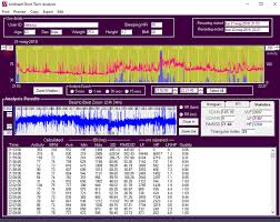 Image result for Actigraphy