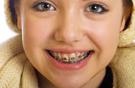 See what vincenzo quinzi (vincenzoq) has discovered on pinterest, the world's biggest collection of ideas. L Ortodonzia Del Piccolo Paziente Perche Come E Quando Dott Vincenzo Quinzi