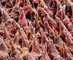 Image result for Filiform Papillae