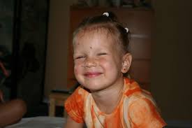 Chicken Pox Pics