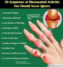 Pin Em Arthritis Gout And Spondylitis
