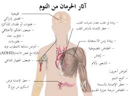 نوم wikiwand
