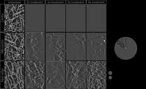 Bacterial endocarditis is a disease with high morbidity and mortality. Plasma Biology And Plasma Medicine Part Ii Plasma Medicine