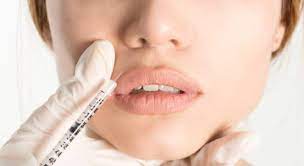 Aplicación de botox es realizada por cirujano plástico miembro de la sociedad de cirujanos plásticos colombianos y speaker mundial en la aplicación de botox. Cuanto Cuestan Los Tratamientos Con Botox En America Latina Eleconomistaamerica Pe