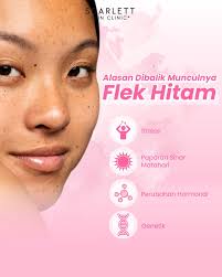 Scarlett Skin Clinic+ Depok (@scarlettskinclinic.depok) • Instagram photos  and videos