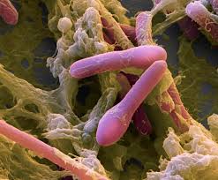 Image result for Clostridium
