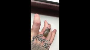 Laser tattoo removal techniques can get rid of your unwanted tattoo with minimal side effects. Newsflare Man Develops Huge Blister On Finger After Session Of Laser Tattoo Removal