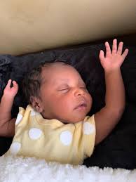 Hi, my beautiful 3 week old baby Saphari Love was born with 2 fingers