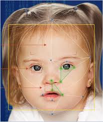 Developmental delay with short stature, dysmorphic features, and sparse hair. Depressed Nasal Bridge Causes Symptom Of A Rare Disease