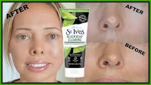 Gently clears breakouts & calms redness. St Ives Blackhead Clearing Green Tea Scrub Review Youtube